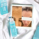 Clareador Íntimo e Corporal Lumier